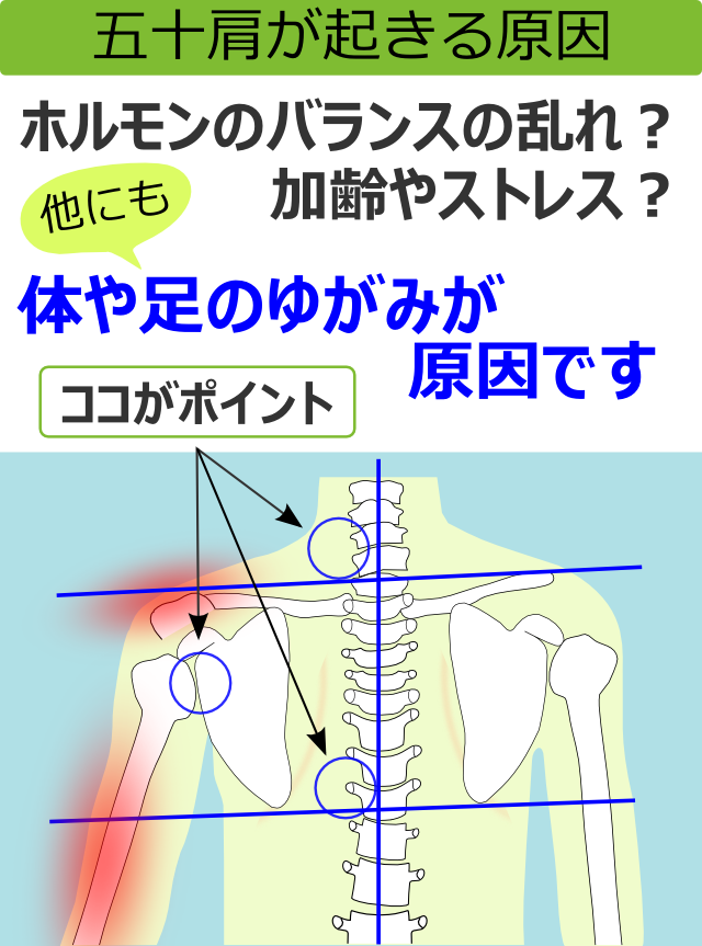 五十肩が起きる原因