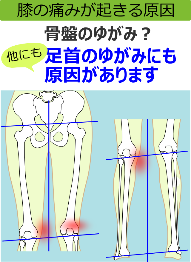 膝の痛みが起きる原因