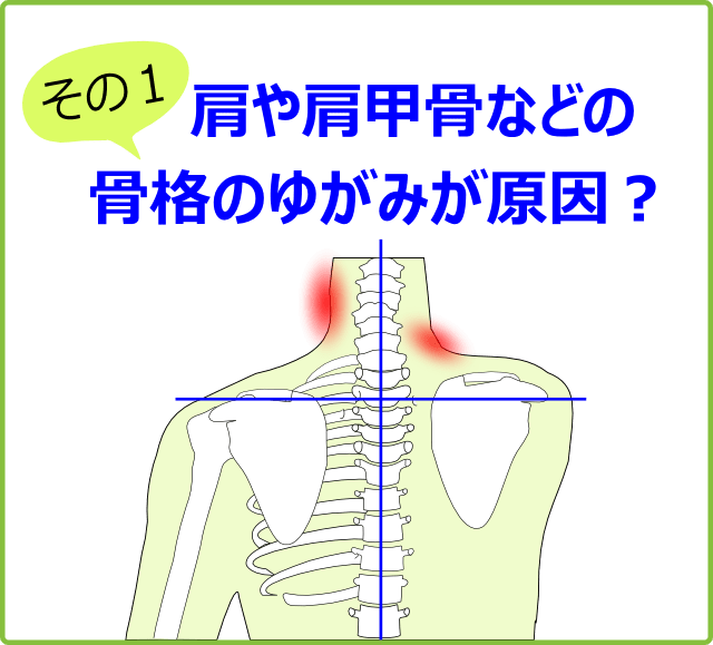 肩や肩甲骨などの骨格のゆがみが原因？