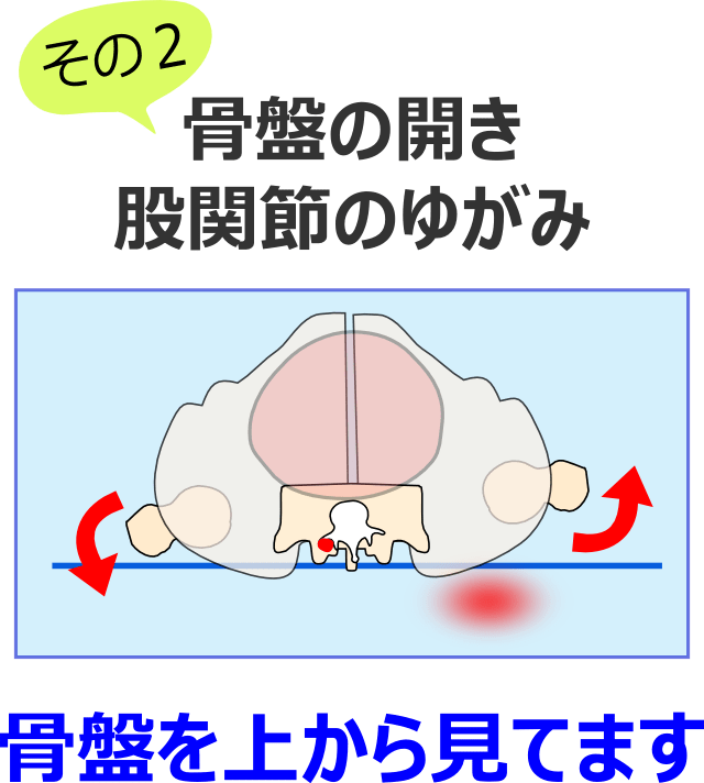 骨盤の開きと股関節のゆがみ