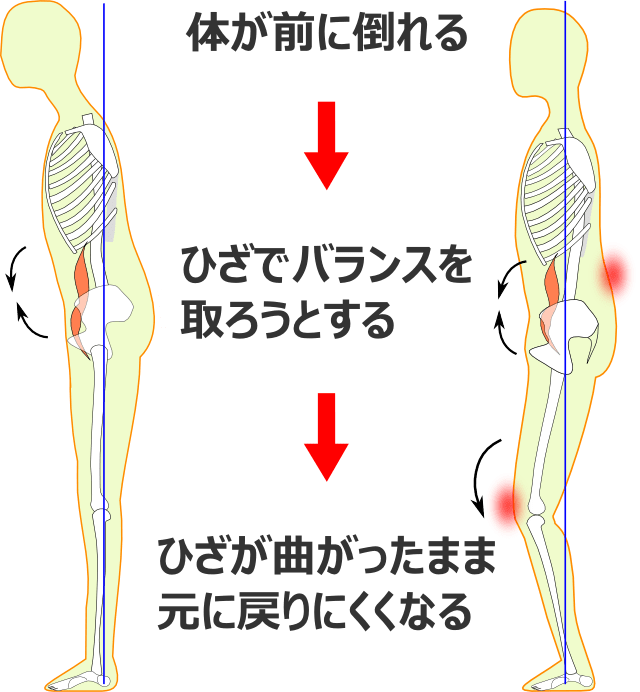 体のゆがみの過程2