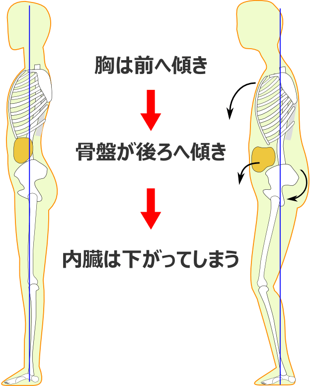 体のゆがみの過程3